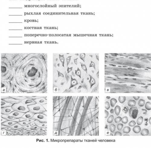 Какая ткань изображена на рисунке эпителиальная мышечная соединительная нервная