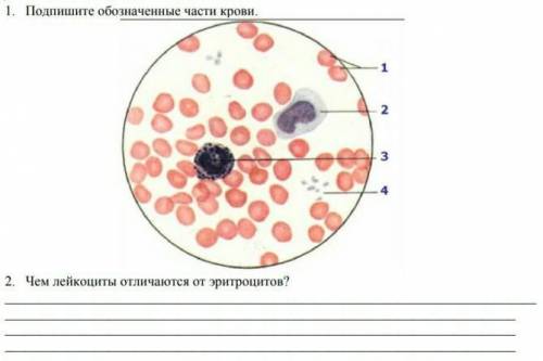 Лейкоциты в отличие от эритроцитов. Подпишите части крови. Подпиши части крови 4 класс. Барабанные палочки в лейкоцитах.